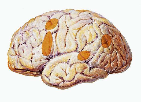 我們?nèi)绾螏椭X損傷兒童過渡到學校？