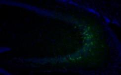 早期生活經(jīng)歷影響成人大腦中的DNA