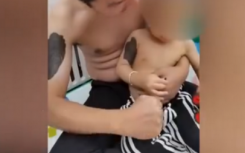 爸爸定制兒子同款胎記紋身貼紙送孩子開刀不忍心