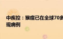 中疾控：猴痘已在全球70多個國家和地區(qū)傳播 我國尚未發(fā)現(xiàn)病例