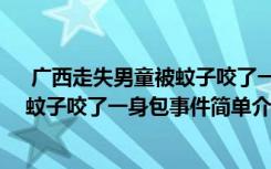  廣西走失男童被蚊子咬了一身包怎么回事 廣西走失男童被蚊子咬了一身包事件簡單介紹