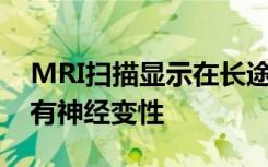 MRI掃描顯示在長途飛行中大腦會重組 但沒有神經(jīng)變性