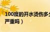 100度的開(kāi)水燙傷多久會(huì)好（100度開(kāi)水燙傷嚴(yán)重嗎）