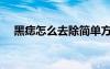 黑痣怎么去除簡(jiǎn)單方法（黑痣怎么去除）
