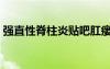 強直性脊柱炎貼吧肛瘺（強直性脊柱炎貼吧）