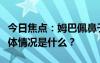 今日焦點(diǎn)：姆巴佩鼻子受傷賽后送醫(yī)治療，具體情況是什么？