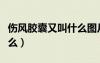 傷風膠囊又叫什么圖片板裝（傷風膠囊又叫什么）