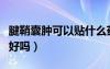 腱鞘囊腫可以貼什么藥膏（腱鞘囊腫貼膏藥能好嗎）