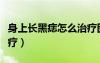身上長(zhǎng)黑痣怎么治療圖片（身上長(zhǎng)黑痣怎么治療）