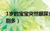1歲的寶寶突然眼屎多（1歲寶寶突然眼屎特別多）