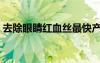 去除眼睛紅血絲最快產(chǎn)品（去除眼睛紅血絲）