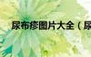 尿布疹圖片大全（尿布疹什么樣子圖片）