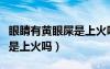 眼睛有黃眼屎是上火嗎怎么辦（眼睛有黃眼屎是上火嗎）