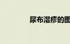 尿布濕疹的圖片（尿布濕）