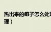 熱出來的痱子怎么處理（熱出來的痱子如何處理）